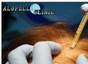 Alopell Clinic