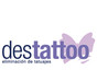 Destattoo