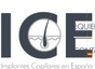 ICE Implantes Capilares España