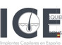 ICE Implantes Capilares España