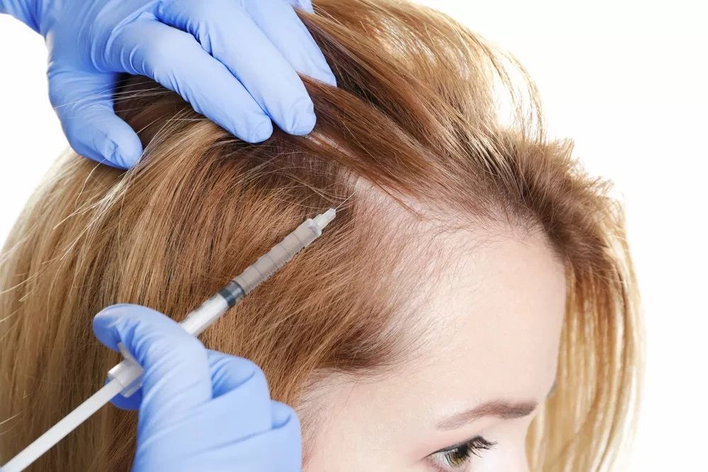 tratamiento de dutasterida para la alopecia