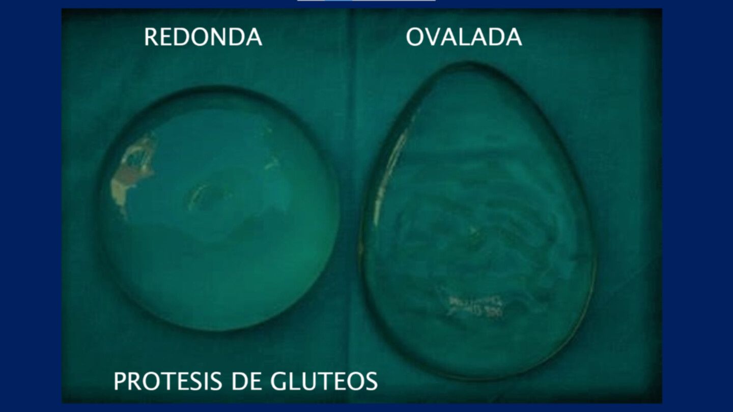 Tipos de prótesis de glúteos