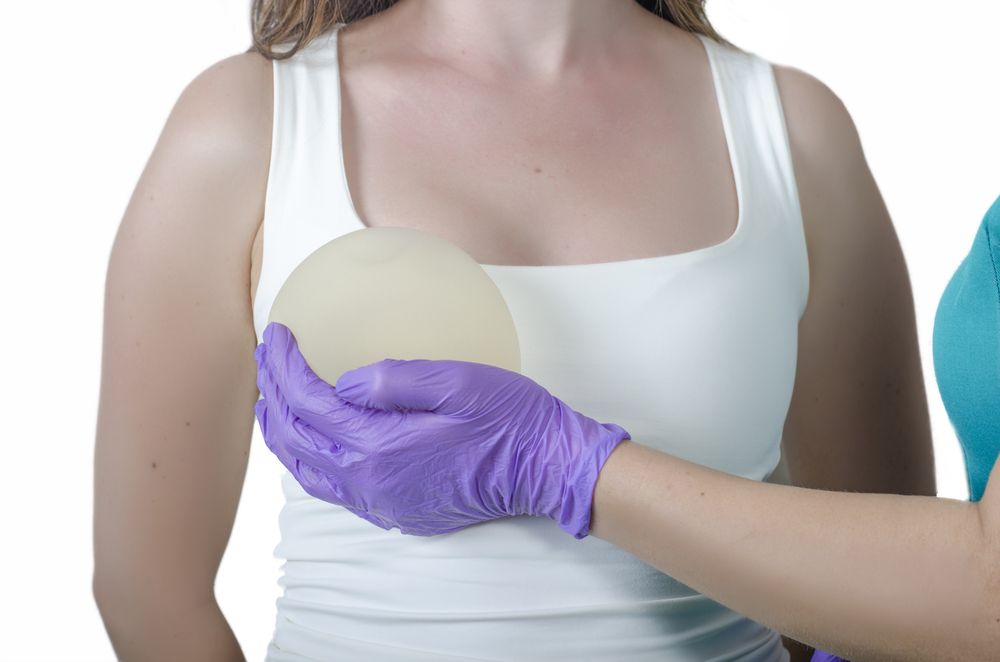 reconstrucción mamaria con implantes de pecho