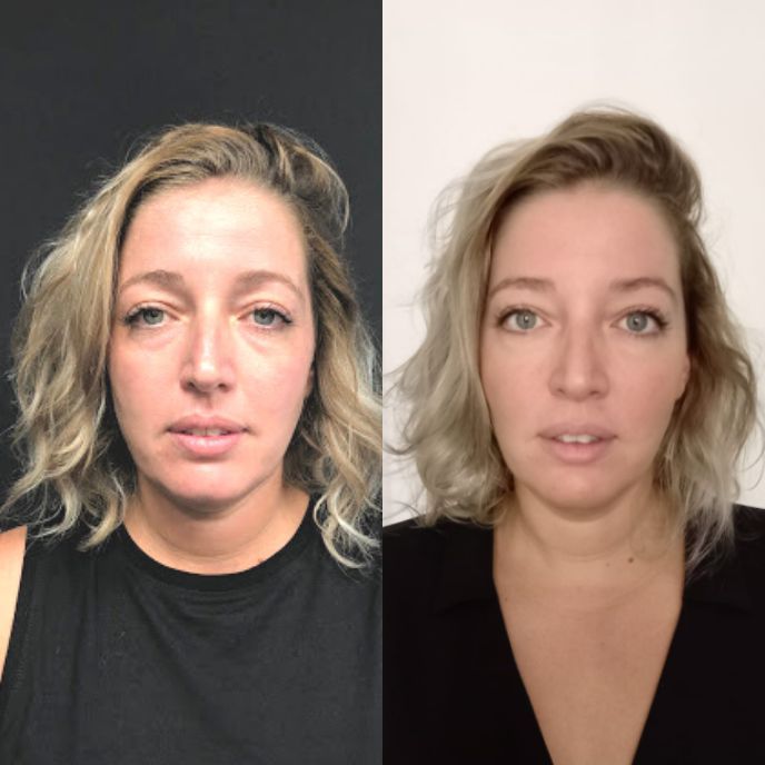 antes y después rediseño de mirada