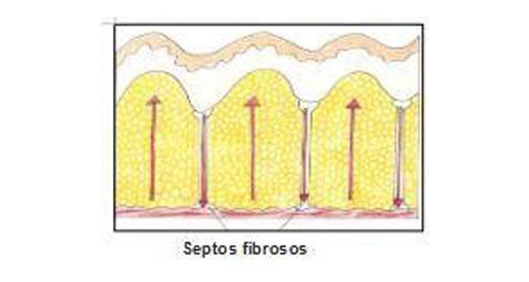 septos fibrosos