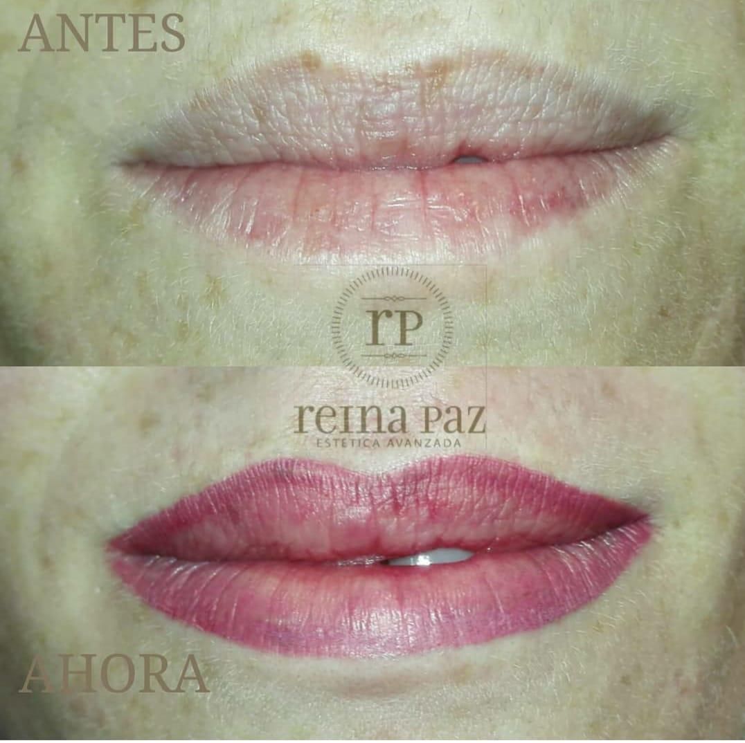 antes y después micropigmentación labial