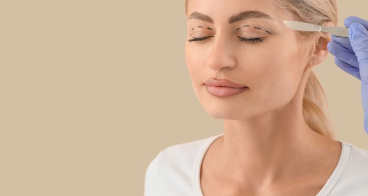 Blefaroplastia