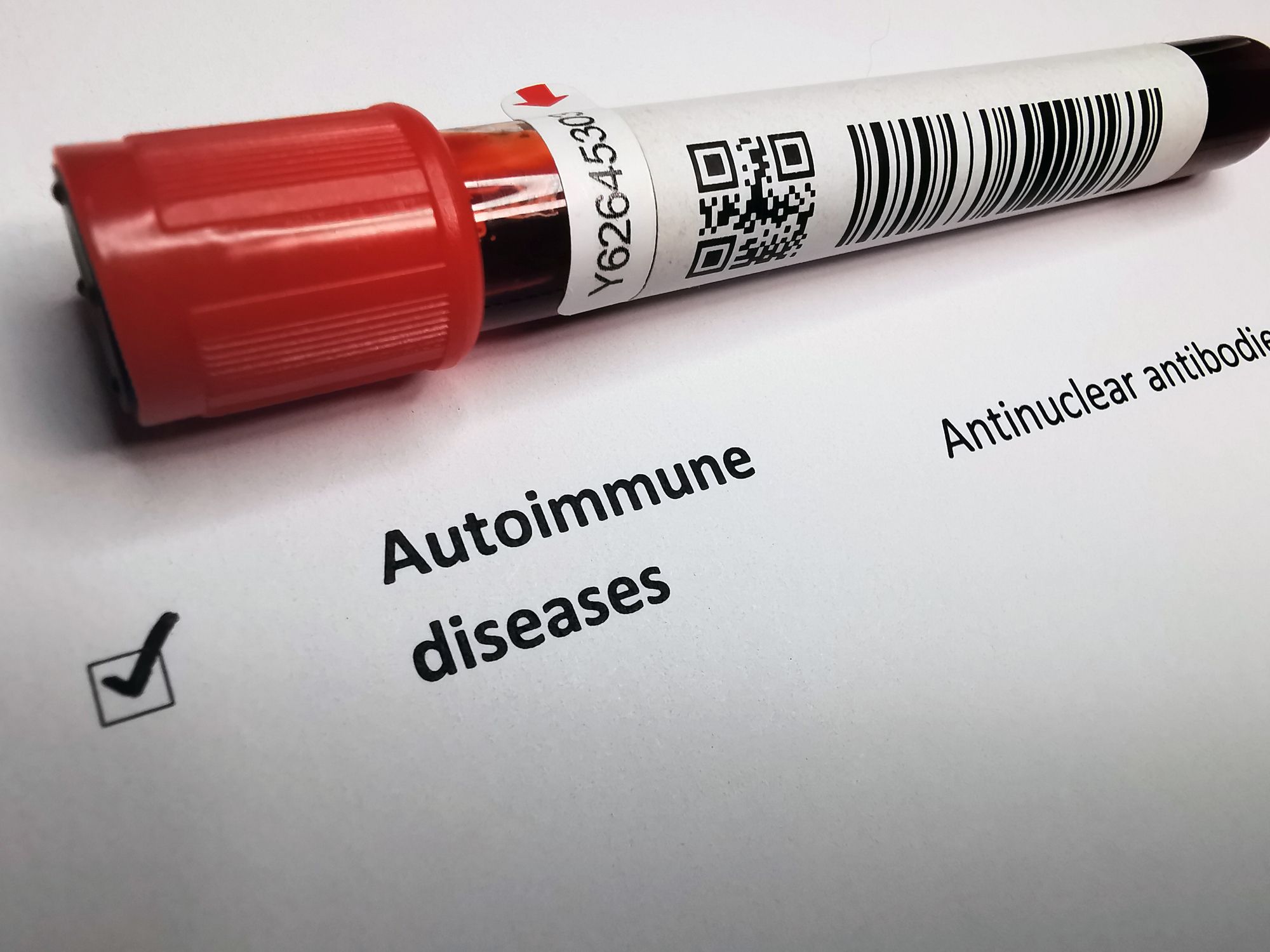 autoinmunes y medicina estética