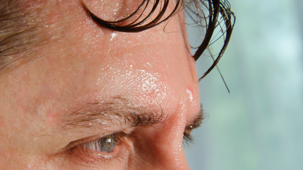 hiperhidrosis