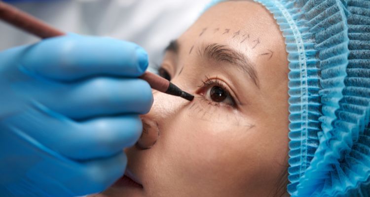Blefaroplastia