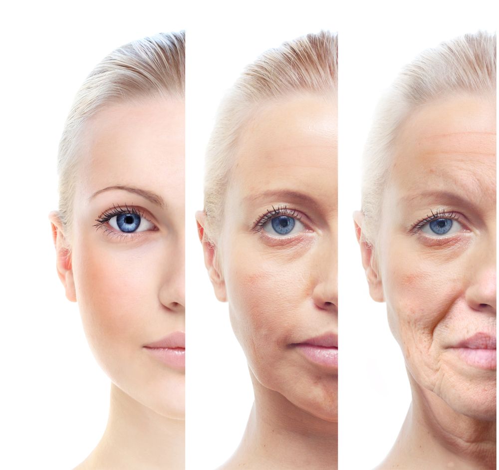 botox en crema
