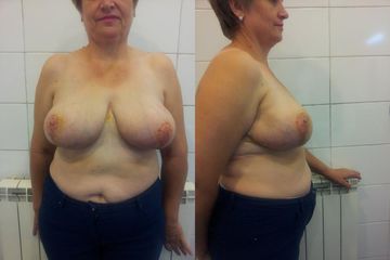 20140919 181147
