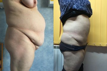 IMG 4113