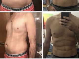 Marcación abdominal 