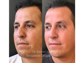 Dr. Kochol R. Ariel 