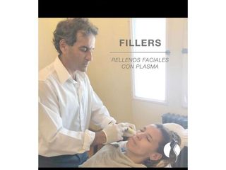 Rellenos faciales