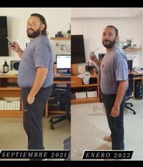 Manga gástrica - Dr. Diego Cunille