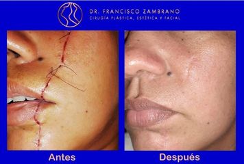 Reconstruccion facial