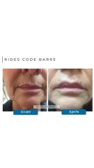 Rides Code Barre - Dr De Goursac