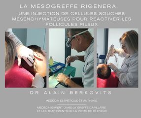 Mésothérapie - Dr Alain Berkovits