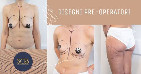 Dott. Manuel De Giovanni Disegni pre-operatori