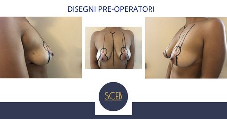 Dott. Manuel De Giovanni Disegni pre opertori