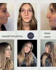 Dott. Manuel De Giovanni Rinosettoplastica