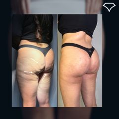 Dott. Dario Martusciello Diamond Incision