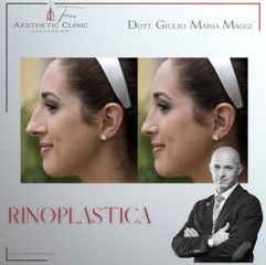 Rinoplastica - Aesthetic Clinic del Dott. Giulio Maria Maggi