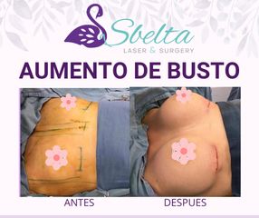 Aumento de busto - Dra. Jessica Ramirez Cadena