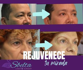 Blefaroplastia