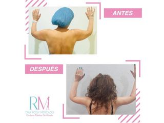 Antes y después de braquioplastia- Dra. Rosy Mercado 