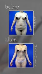 MOM- Dr Rodrigo Valero