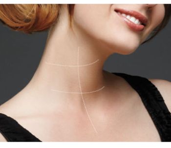 Cómo rejuvenecer el cuello con o sin cirurgía
