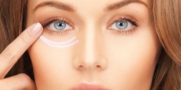 Ojeras: nueva solución con ácido hialurónico