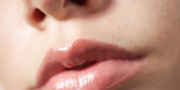 Queiloplastia no quirúrgica