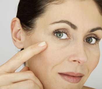 Arrugas: por qué se forman y cómo prevenirlas
