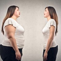 Balón intragástrico, una solución al sobrepeso