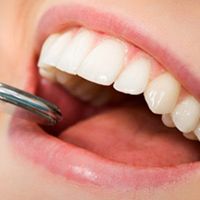 Tipos y Cuidados para la reconstrucción dental