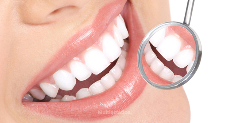 ¿Te da vergüenza enseñar los dientes ¡Ponte unas carillas dentales!
