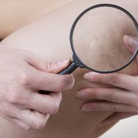 Lipovacuum: cuatro tratamientos en uno