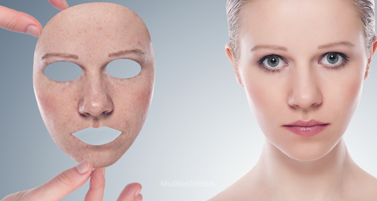 ¿Qué necesitamos saber antes de hacernos un peeling químico?