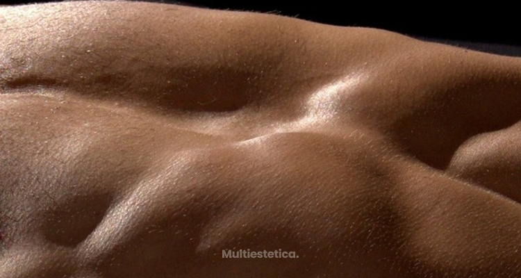 Técnicas para lucir abdominales de manera segura