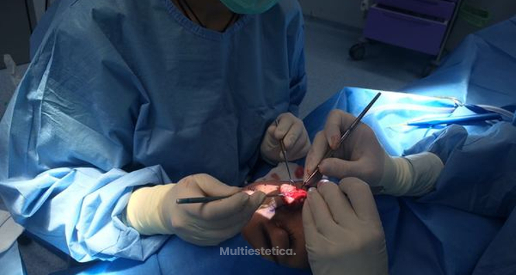 Posibles combinaciones de cirugia facial