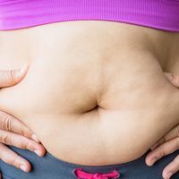 Tipos de abdominoplastia: ¿cuál es la más acertada en cada caso?