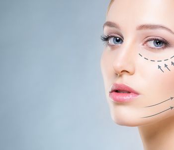 Ritidoplastia, ritidectomía o lifting facial