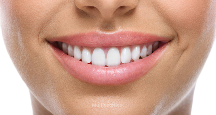 Mejora tu sonrisa sin dolor con las carillas Lumineers