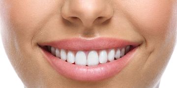 Mejora tu sonrisa sin dolor con las carillas Lumineers