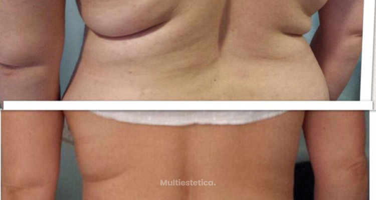 Reducir una talla sin dietas ni ejercicios es posible.