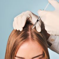 La alopecia: por qué se produce y cómo tratarla